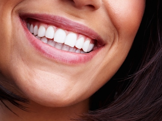 Close up of woman smiling with flawlessly straight white teeth