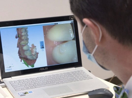 Dentist looking at digital impressions of teeth on computer screen