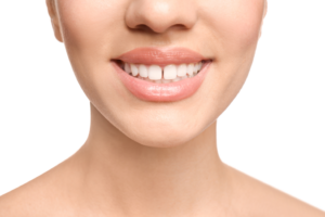 a closeup of a patient with a gap between her front teeth